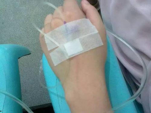 医生爆料打吊瓶视频真实,揭秘打吊瓶视频背后的医疗乱象